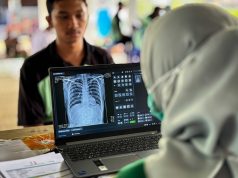 Lapas Lombok Barat Skrining TBC Seluruh Warga Binaan